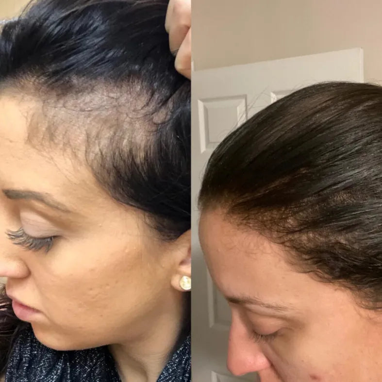 Seapuri™ Daily Scalp Serum by SelfSerum
