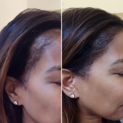 Seapuri™ Daily Scalp Serum by SelfSerum
