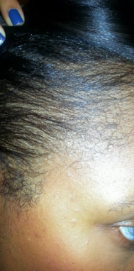 After 2 Months