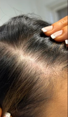 After 9 weeks