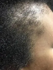 After 8 weeks