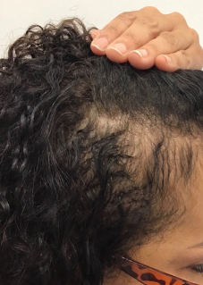 After 6 months