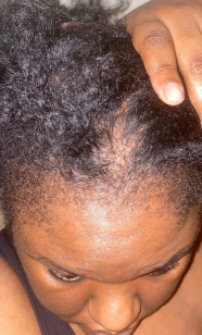 After 8 months